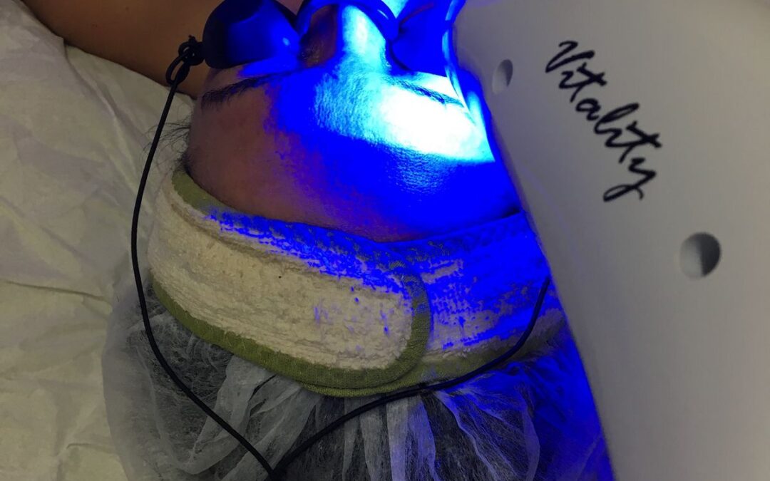 Protocolo de clareamento de pele com Peeling Vegetal Planta Líquida  e ledterapia