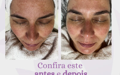 O inverno escancara o que o verão disfarça: o cansaço no rosto